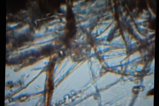 Mikroskop - foto