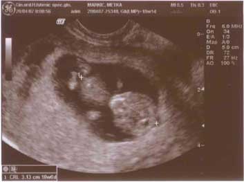 10t1d, 20.04.2007